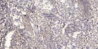 Tie-2 (phospho Tyr992) Polyclonal Antibody