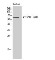 TIP60 (phospho Ser86) Polyclonal Antibody