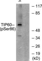 TIP60 (phospho Ser86) Polyclonal Antibody