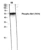 Akt1 (phospho Tyr474) Polyclonal Antibody