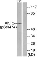 Akt2 (phospho Ser474) Polyclonal Antibody