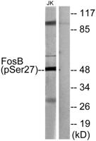 Fos B (phospho Ser27) Polyclonal Antibody