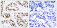 RelB (phospho Ser552) Polyclonal Antibody