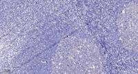 Ret (phospho Tyr1015) Polyclonal Antibody