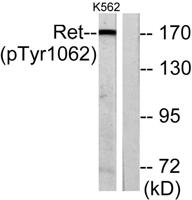 Ret (phospho Tyr1062) Polyclonal Antibody