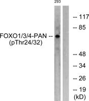 FoxO1/3/4 (phospho Thr24/32) Polyclonal Antibody