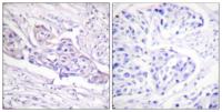 FoxO1A (phospho Ser329) Polyclonal Antibody