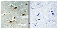 FoxO4 (phospho Ser197) Polyclonal Antibody