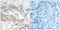 FoxO4 (phospho Ser197) Polyclonal Antibody