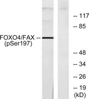 FoxO4 (phospho Ser197) Polyclonal Antibody