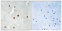 FoxO4 (phospho Ser262) Polyclonal Antibody