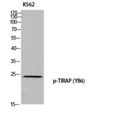 TIRAP (phospho Tyr86) Polyclonal Antibody