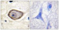 TF (phospho Ser290) Polyclonal Antibody