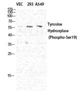 TH (phospho Ser19) Polyclonal Antibody