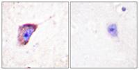 TH (phospho Ser19) Polyclonal Antibody