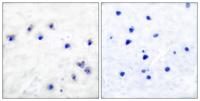 TH (phospho Ser19) Polyclonal Antibody