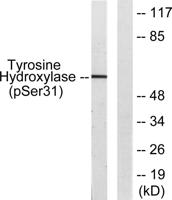 TH (phospho Ser62) Polyclonal Antibody