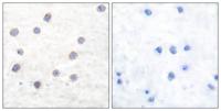 TH (phospho Ser71) Polyclonal Antibody