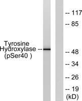 TH (phospho Ser71) Polyclonal Antibody