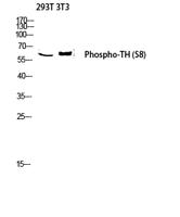 TH (phospho Ser8) Polyclonal Antibody