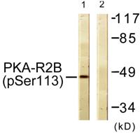 PKA IIβ reg (phospho Ser113) Polyclonal Antibody