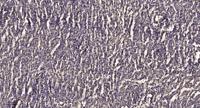 PKAα/β/γ cat (phospho Thr197) Polyclonal Antibody