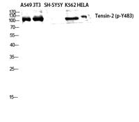 Tensin-2 (phospho Tyr483) Polyclonal Antibody