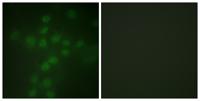 TERT (phospho Ser227) Polyclonal Antibody