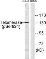 TERT (phospho Ser824) Polyclonal Antibody