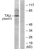 Tau (phospho Ser673) Polyclonal Antibody