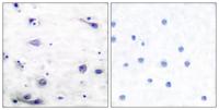 Tau (phospho Ser422) Polyclonal Antibody