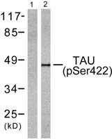 Tau (phospho Ser422) Polyclonal Antibody