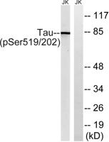 Tau (phospho Ser519) Polyclonal Antibody