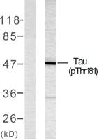 Tau (phospho Thr181) Polyclonal Antibody