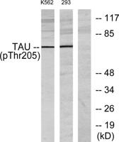 Tau (phospho Thr205) Polyclonal Antibody