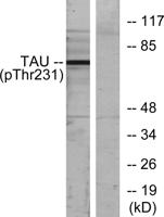 Tau (phospho Thr231) Polyclonal Antibody