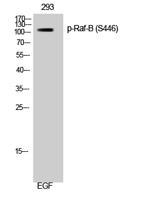 Raf-B (phospho Ser446) Polyclonal Antibody