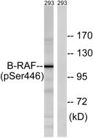 Raf-B (phospho Ser446) Polyclonal Antibody