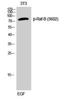 Raf-B (phospho Ser602) Polyclonal Antibody