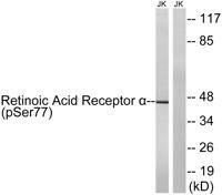 RARα (phospho Ser77) Polyclonal Antibody