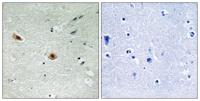 Rb (phospho Ser608) Polyclonal Antibody