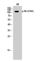 Rb (phospho Ser780) Polyclonal Antibody