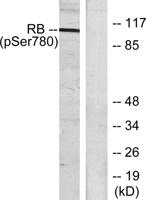 Rb (phospho Ser780) Polyclonal Antibody