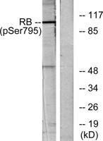 Rb (phospho Ser795) Polyclonal Antibody