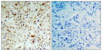 Rb (phospho Ser807) Polyclonal Antibody