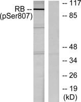 Rb (phospho Ser807) Polyclonal Antibody