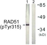 Rad51 (phospho Tyr315) Polyclonal Antibody