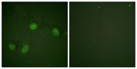 Raf-1 (phospho Ser621) Polyclonal Antibody