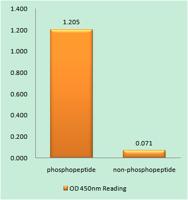 PKC (phospho Thr497) Polyclonal Antibody