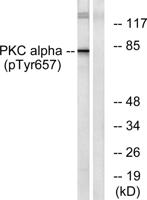 PKC α (phospho Tyr658) Polyclonal Antibody